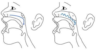 Luchtstroom bij grote neus- en keelamandelen